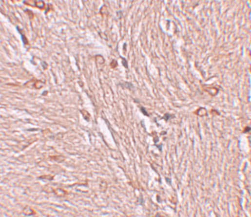 ZBTB4 Antibody - BSA Free