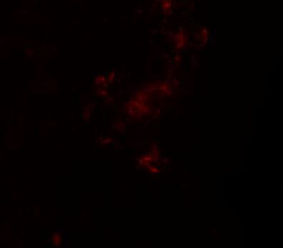 ZBTB5 Antibody - BSA Free