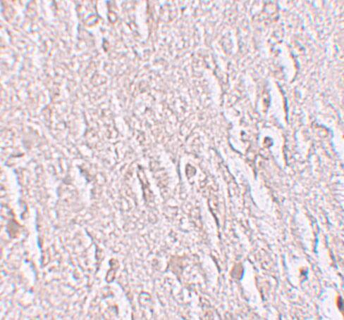 ZBTB5 Antibody - BSA Free