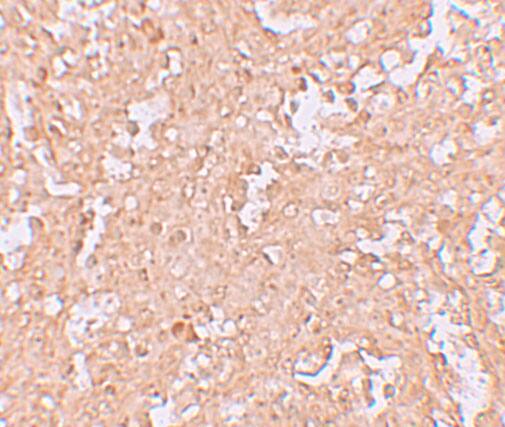 ZBTB8A Antibody - BSA Free