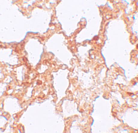 ZMYM1 Antibody - BSA Free