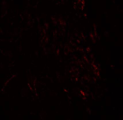 ZMYM3 Antibody - BSA Free