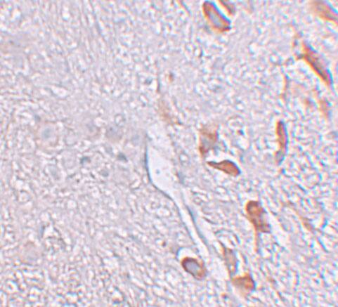 LRRTM1 Antibody - BSA Free
