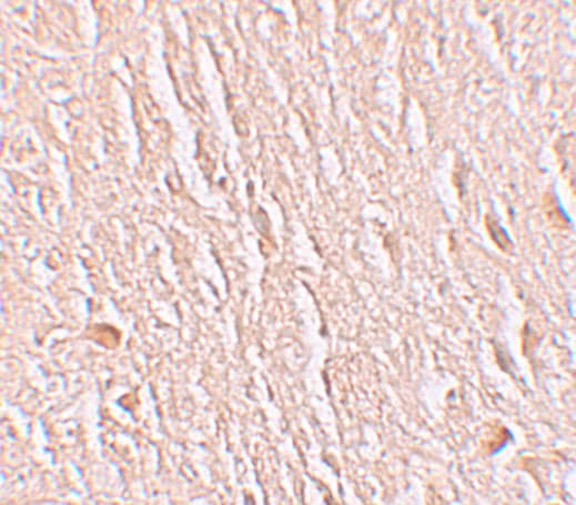 LRRTM3 Antibody - BSA Free