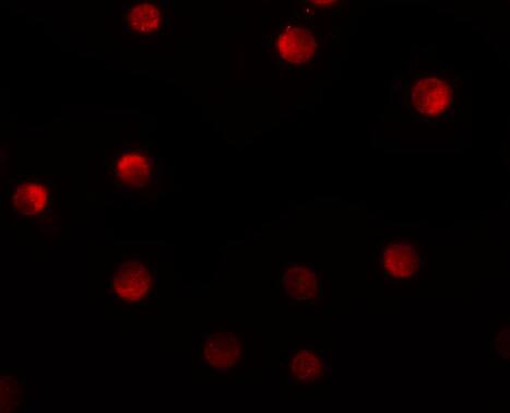 N4BP1 Antibody - BSA Free