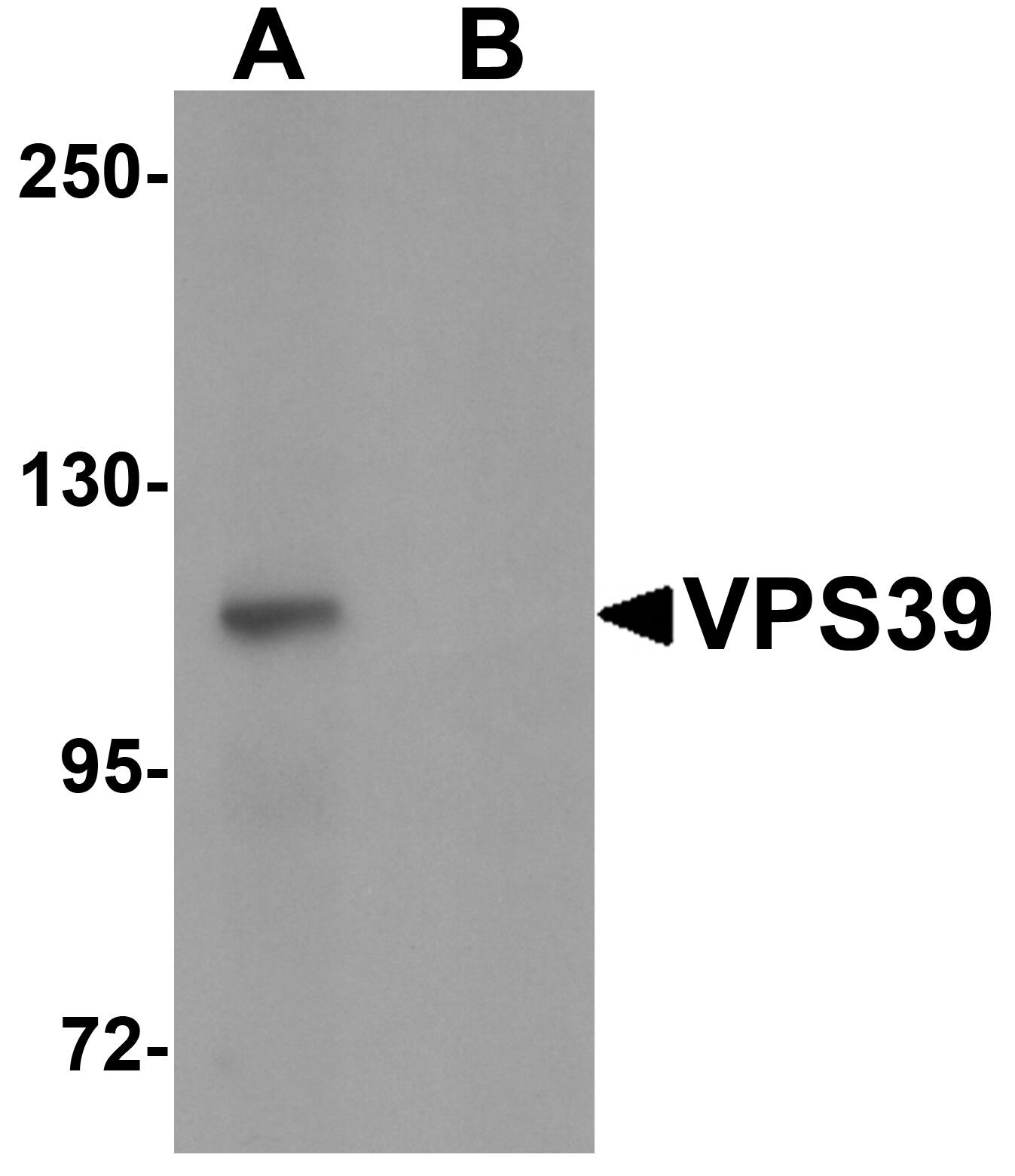 VPS39 Antibody Blocking Peptide