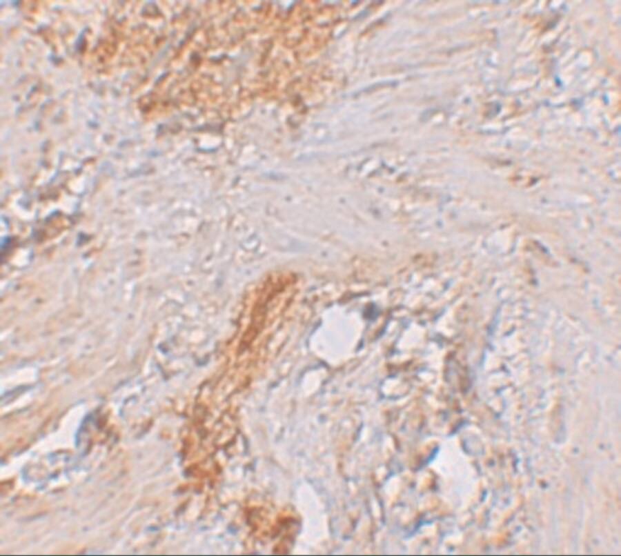 ESRP1 Antibody - BSA Free