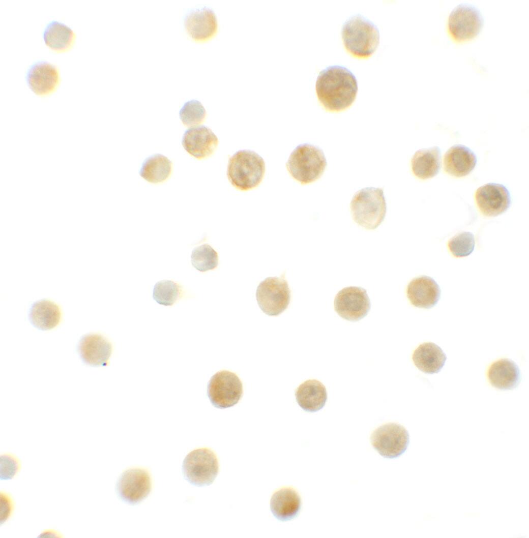 BCL9-2 Antibody - BSA Free