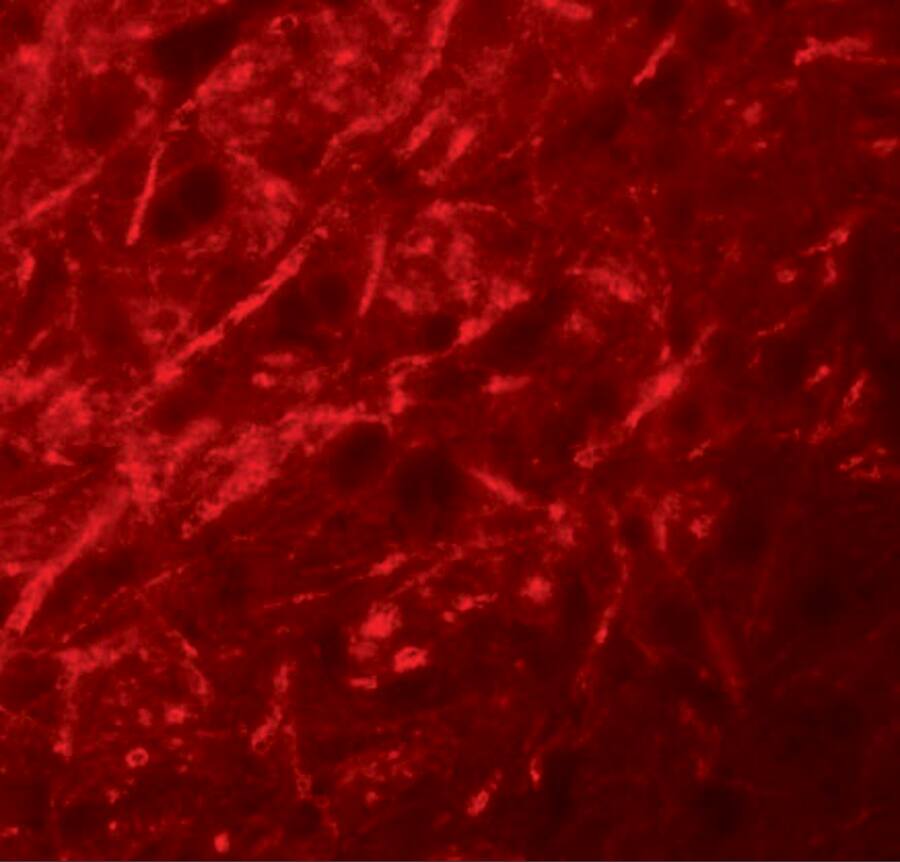 CTNNBL1 Antibody - BSA Free