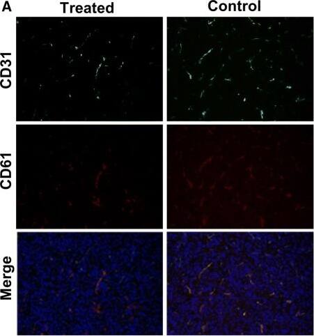 GLS2 Antibody - BSA Free