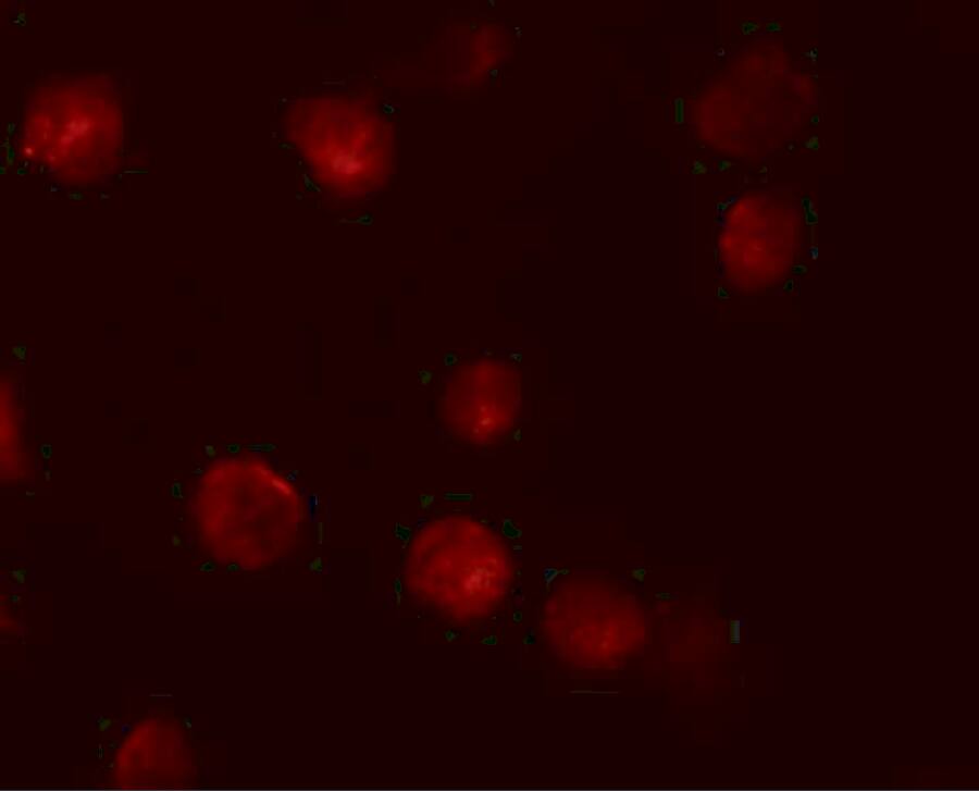 ZMIZ1/Zimp10 Antibody - BSA Free
