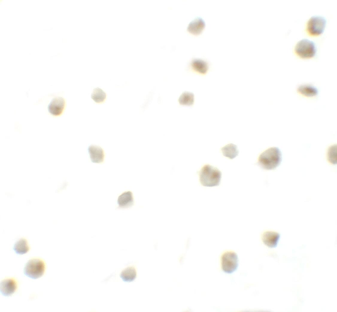 DYRK2 Antibody - BSA Free