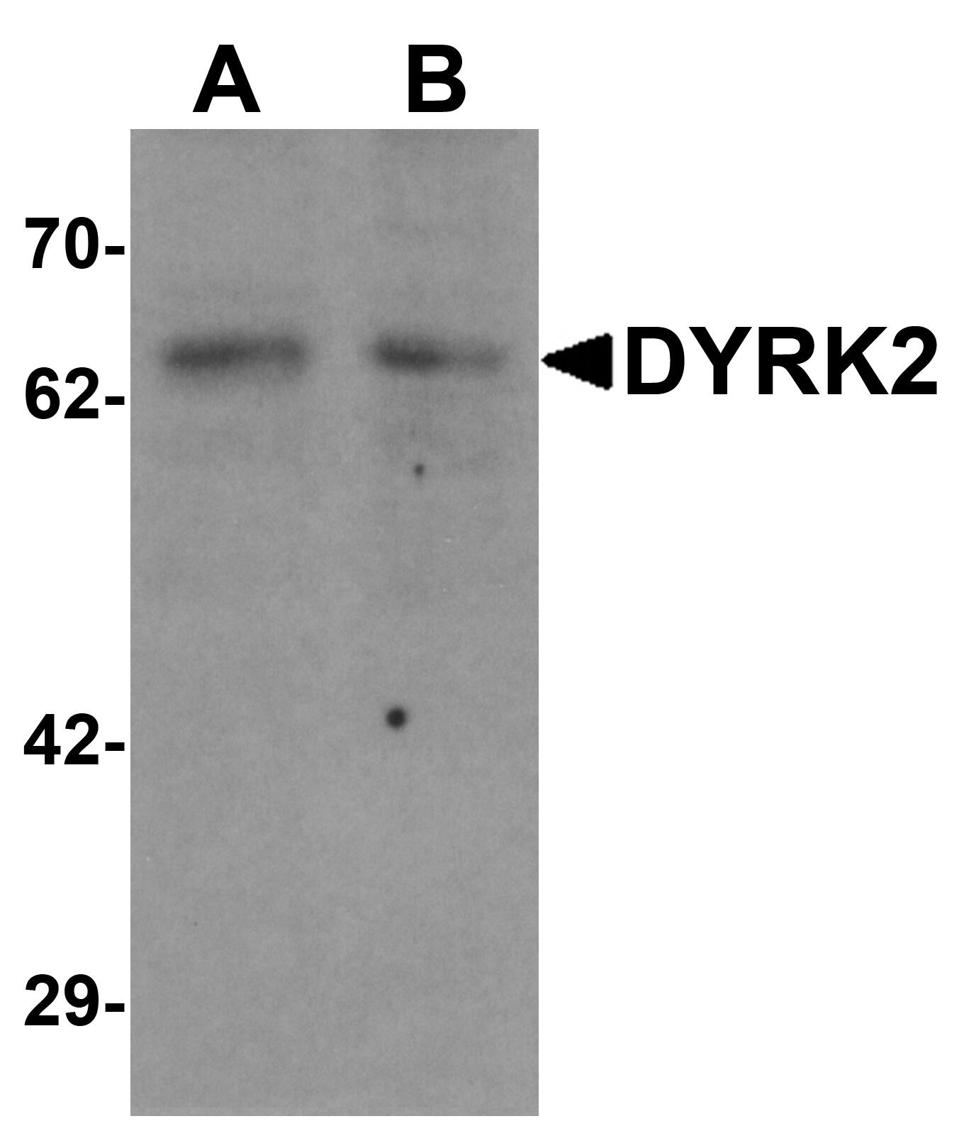 DYRK2 Antibody - BSA Free