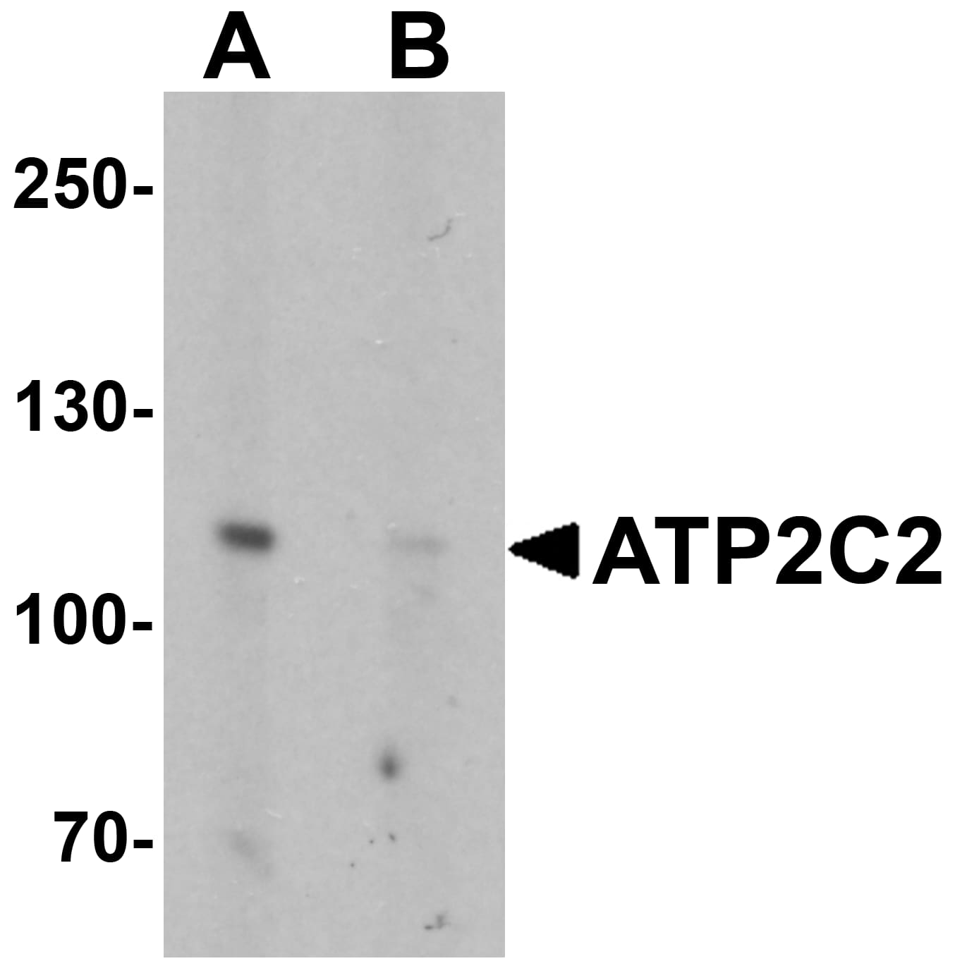 ATP2C2 Antibody - BSA Free