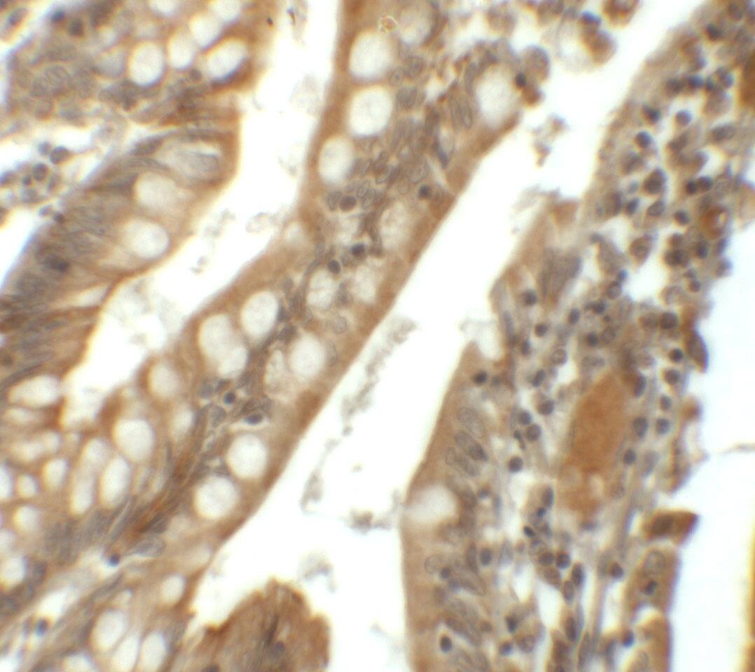 SIK1/Snf1lk Antibody - BSA Free