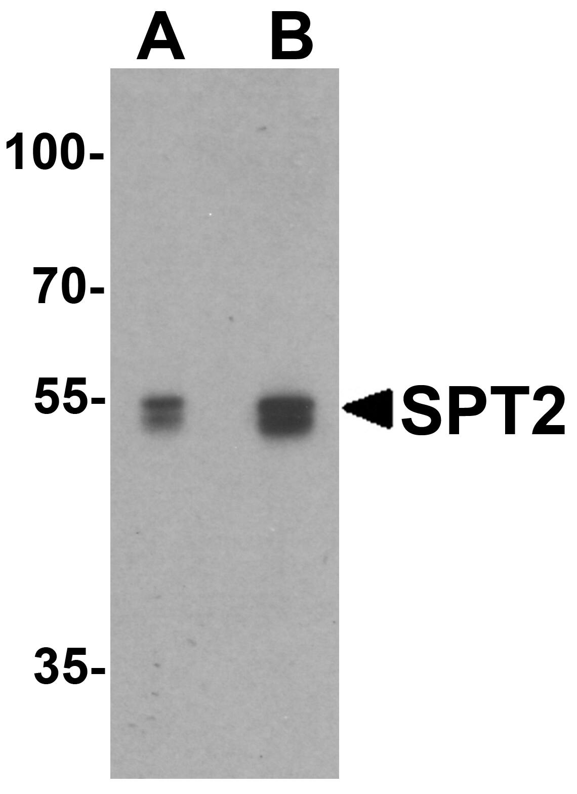 Serine Palmitoyltransferase 2 Antibody - BSA Free
