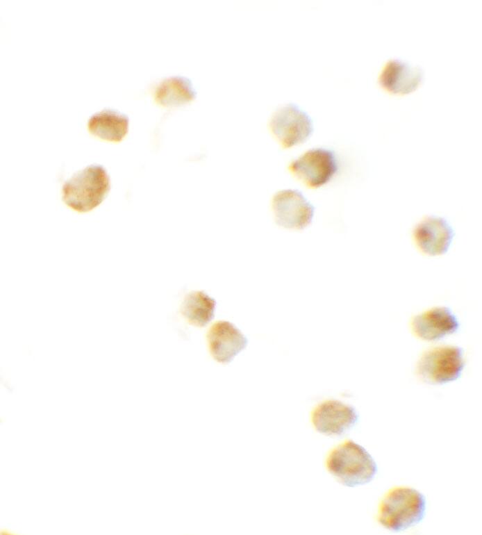 Serine Palmitoyltransferase 2 Antibody - BSA Free