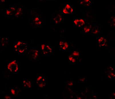 Serine Palmitoyltransferase 2 Antibody - BSA Free