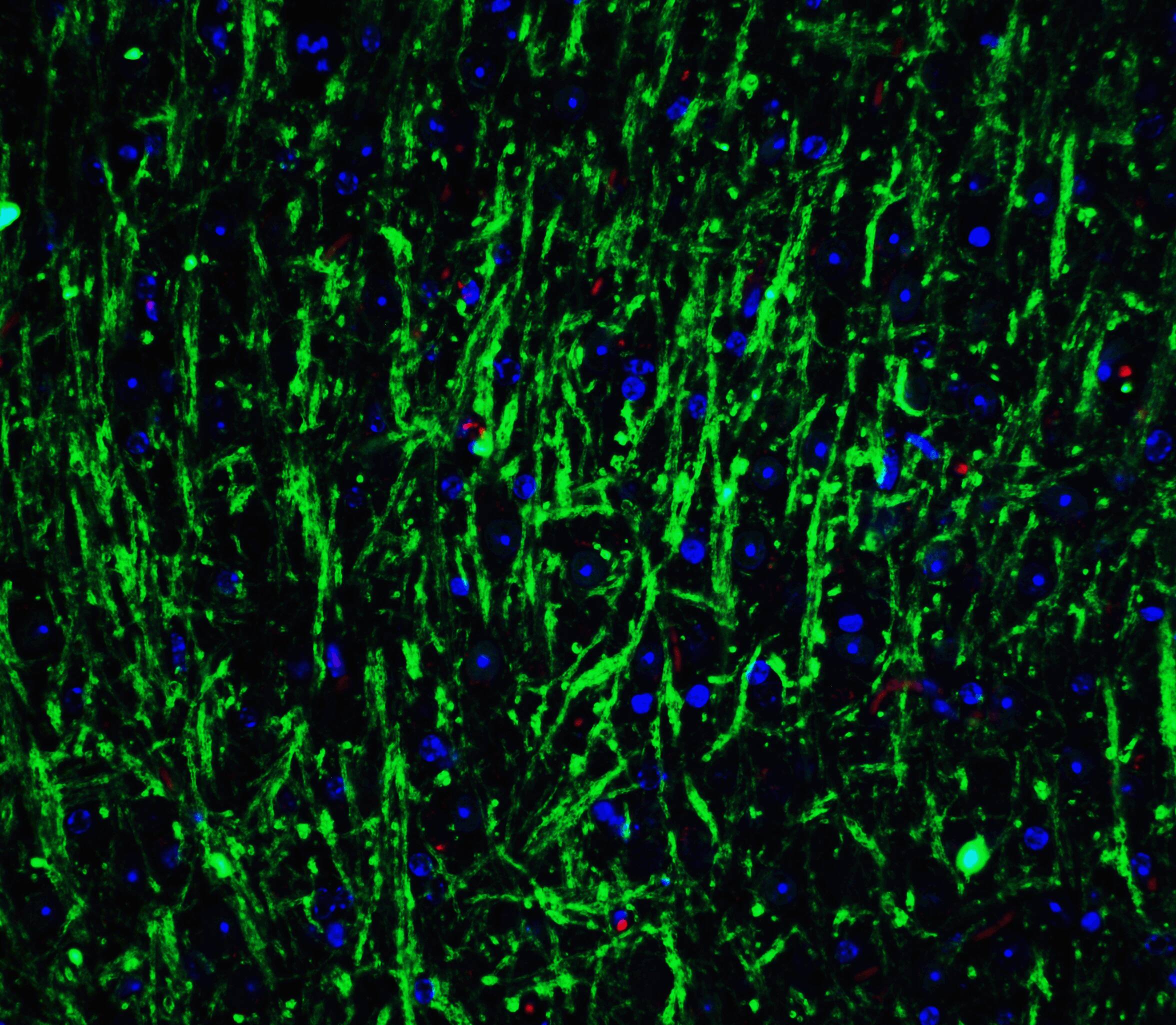 Musashi-2 Antibody - BSA Free