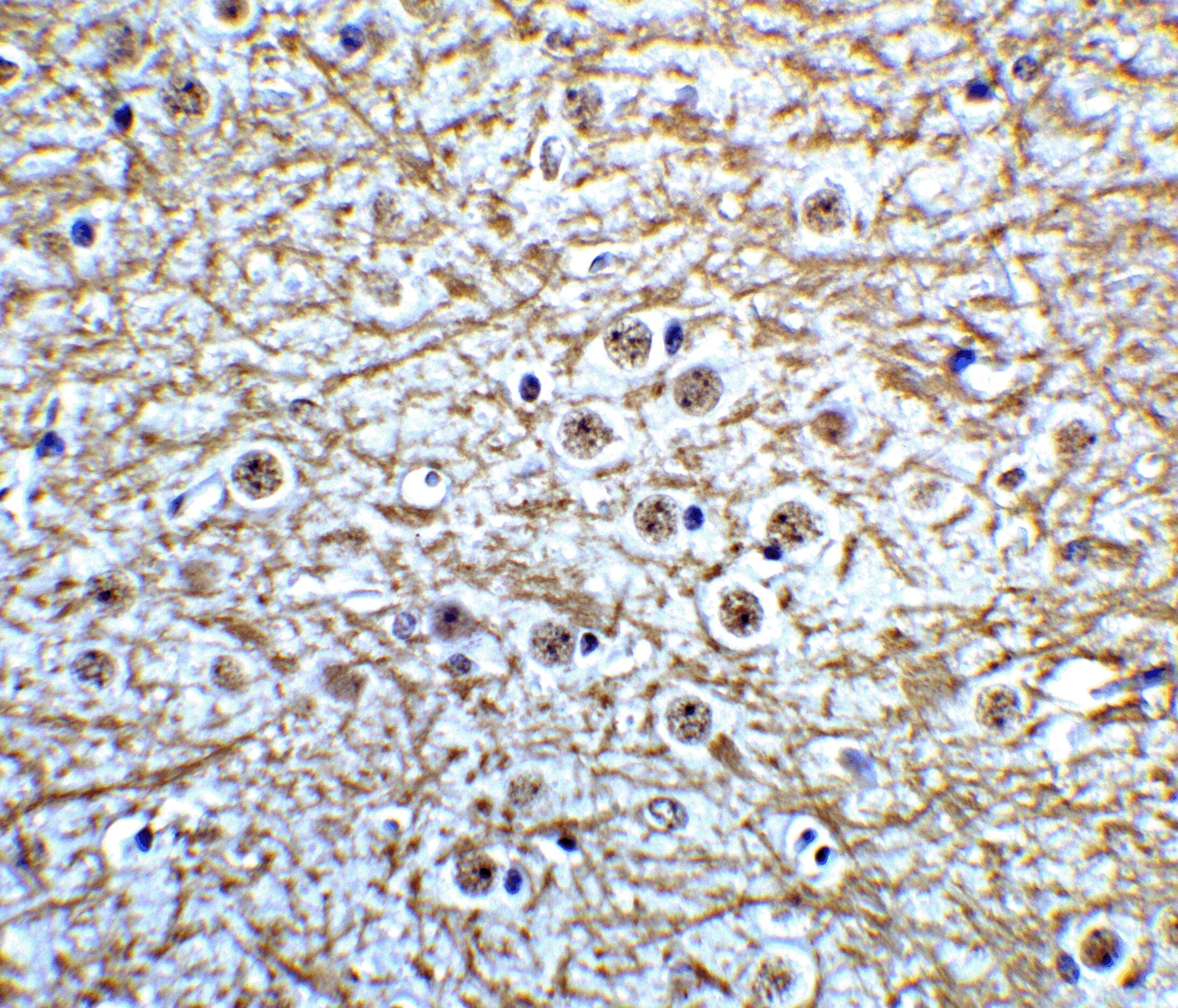 Musashi-2 Antibody - BSA Free
