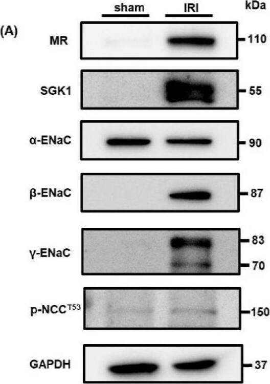 SGK1 Antibody - BSA Free