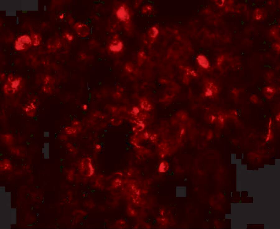 Translin Antibody - BSA Free
