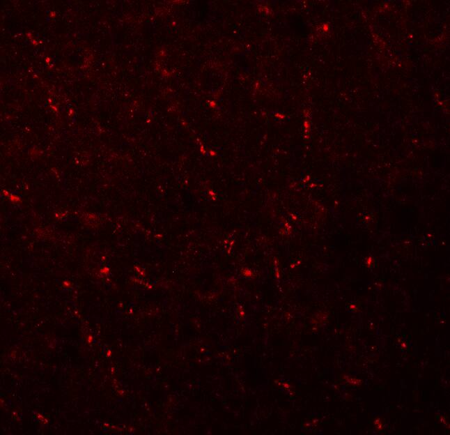 AP3M1 Antibody - BSA Free