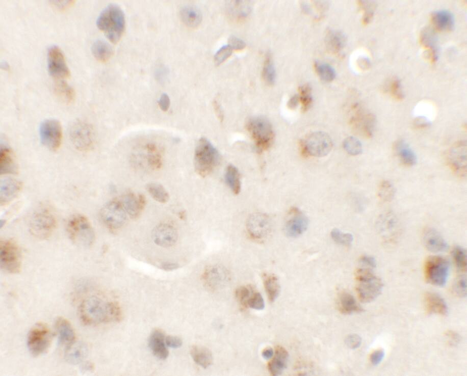 AP3M1 Antibody - BSA Free