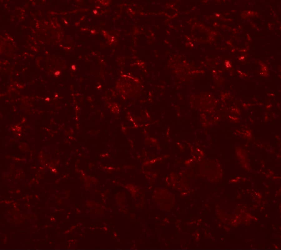 AP3B2 Antibody - BSA Free