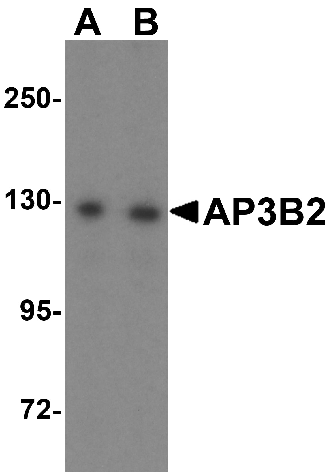 AP3B2 Antibody - BSA Free