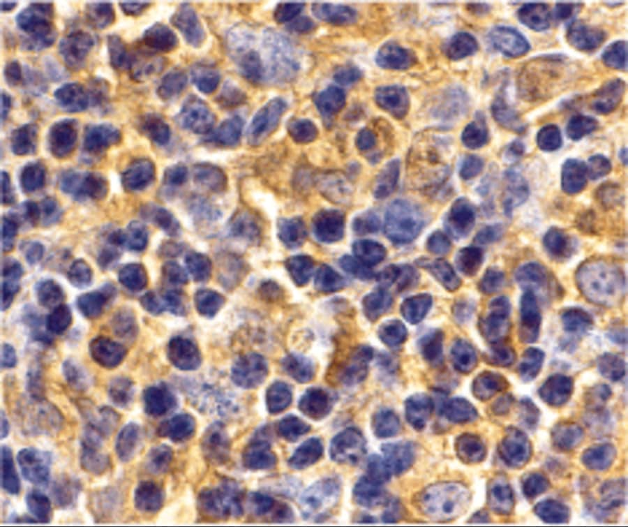 UBE2N/Ubc13 Antibody - BSA Free