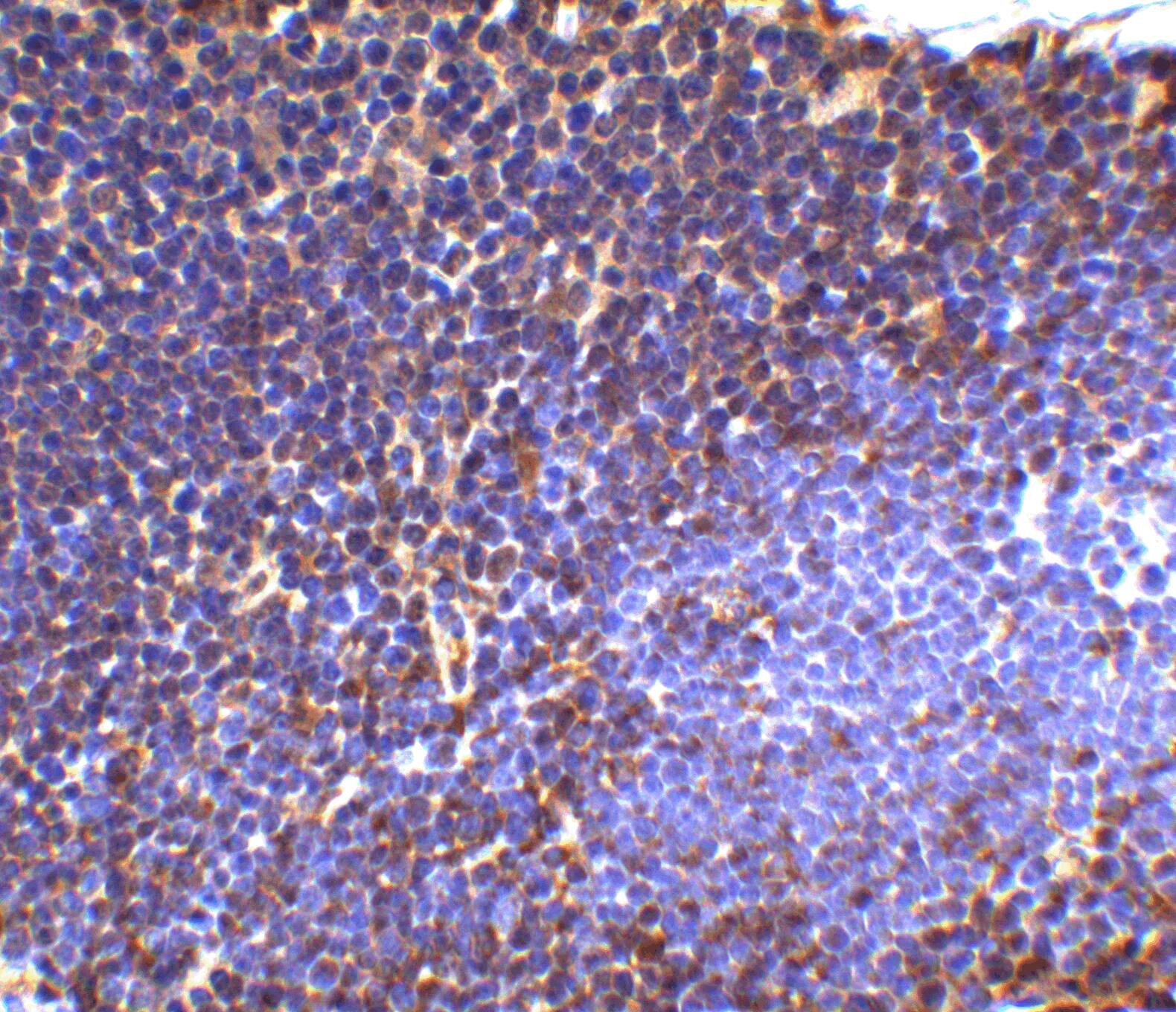UBE2N/Ubc13 Antibody - BSA Free