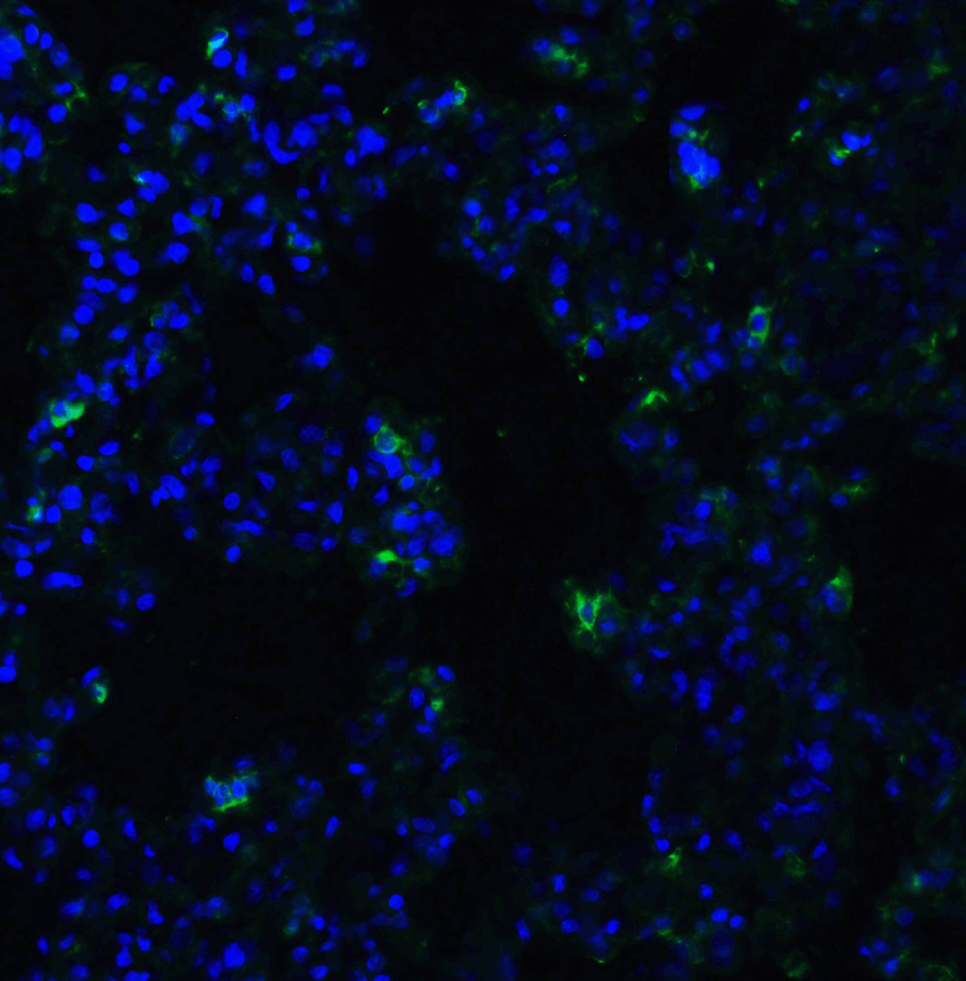 ACE-2 Antibody - BSA Free