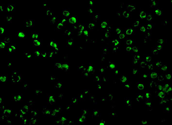 TSC1 Antibody - BSA Free