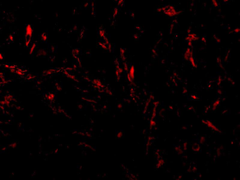 TTC5 Antibody - BSA Free