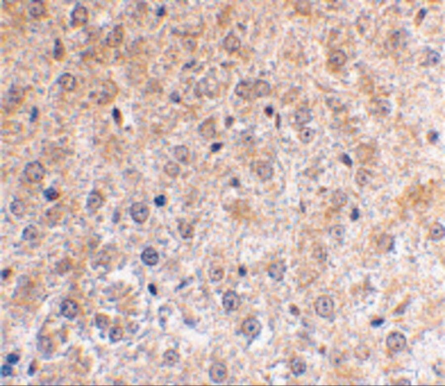 p53 DINP1 Antibody - BSA Free