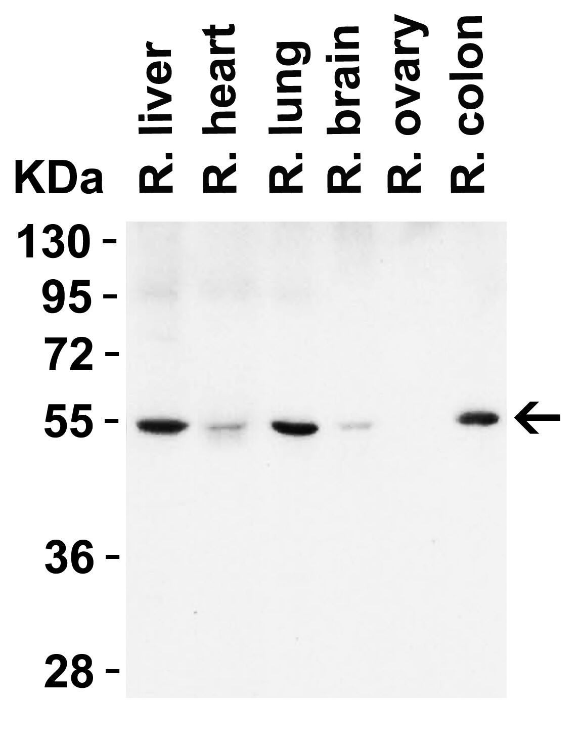 Beclin 1 Antibody - BSA Free