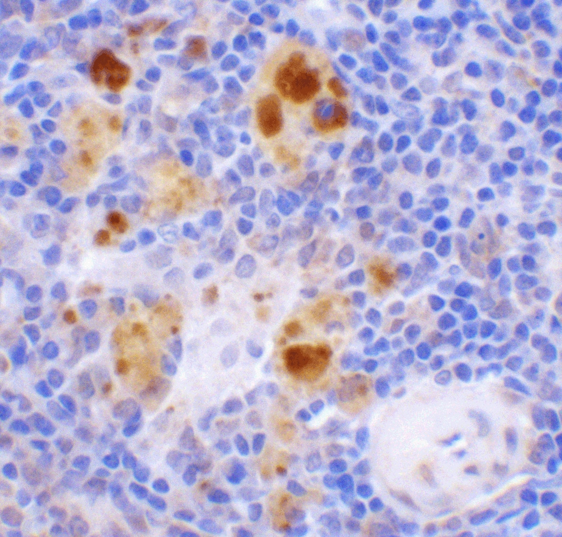 Beclin 1 Antibody - BSA Free