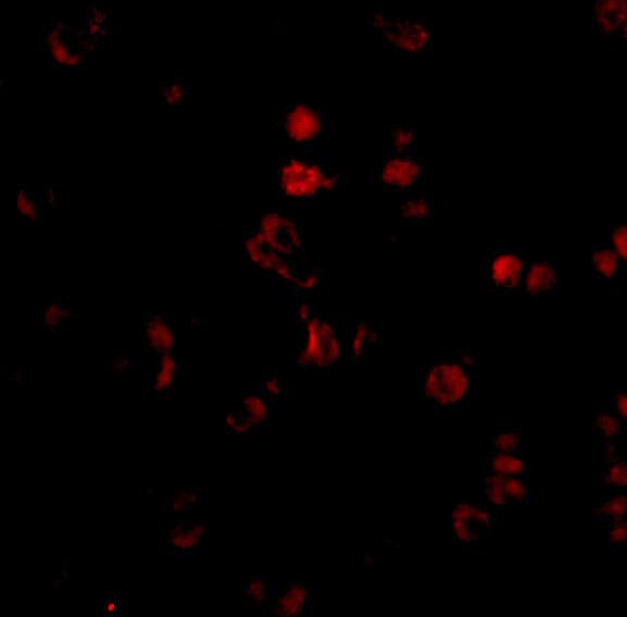 AATF Antibody - BSA Free