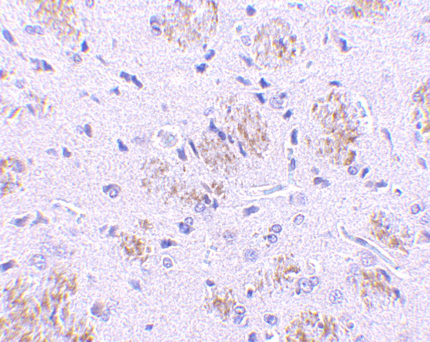 KLHL1 Antibody - BSA Free
