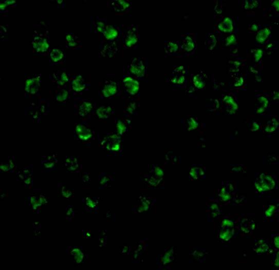 ASK1 Antibody - BSA Free