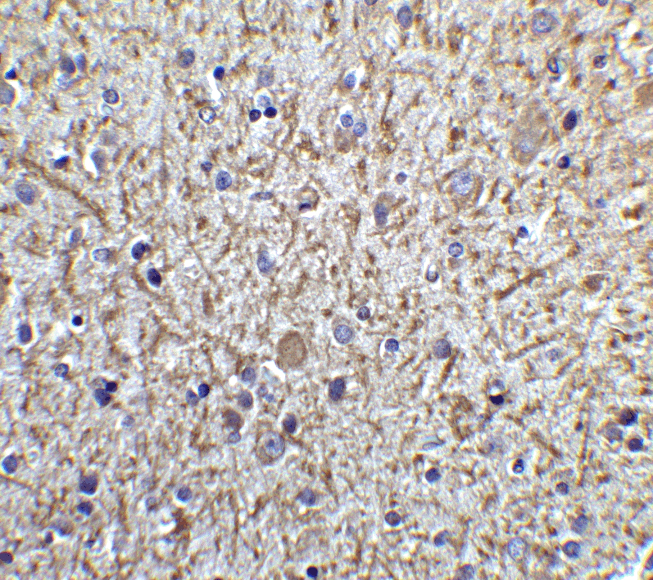 Tollip Antibody - BSA Free