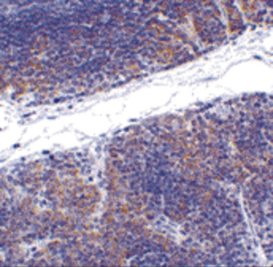 HVEM/TNFRSF14 Antibody - BSA Free