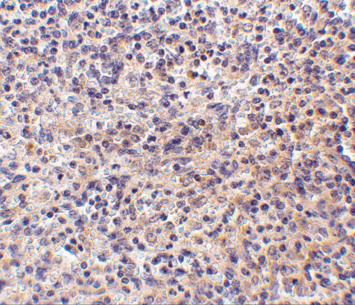 RP105/CD180 Antibody - BSA Free