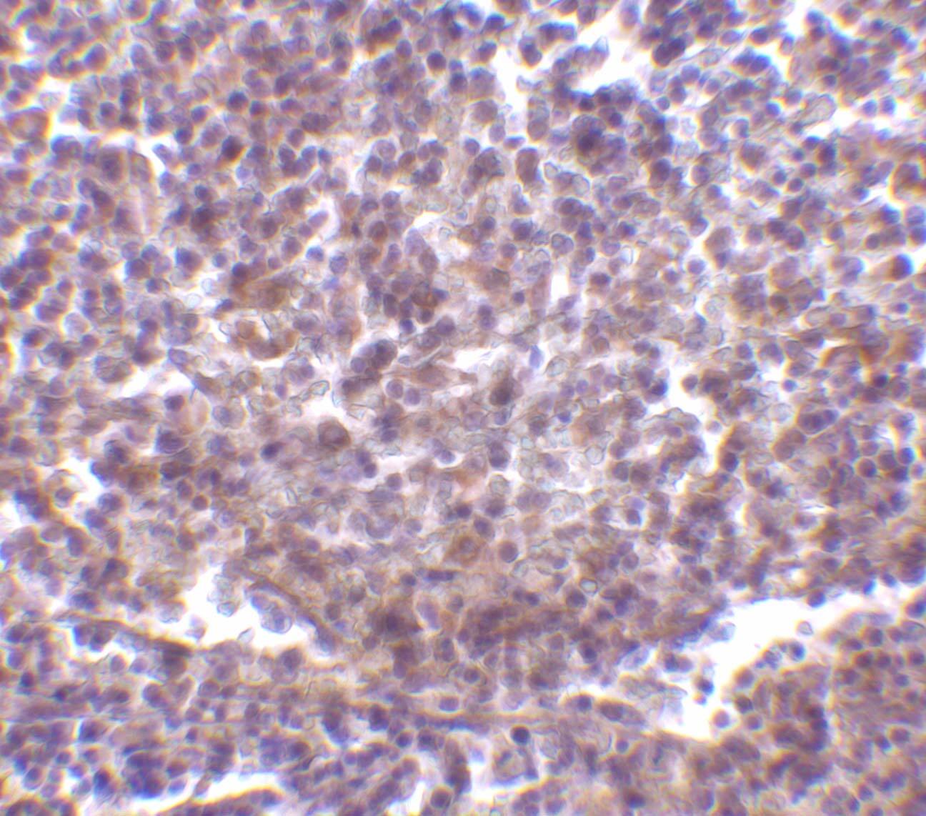 RP105/CD180 Antibody - BSA Free
