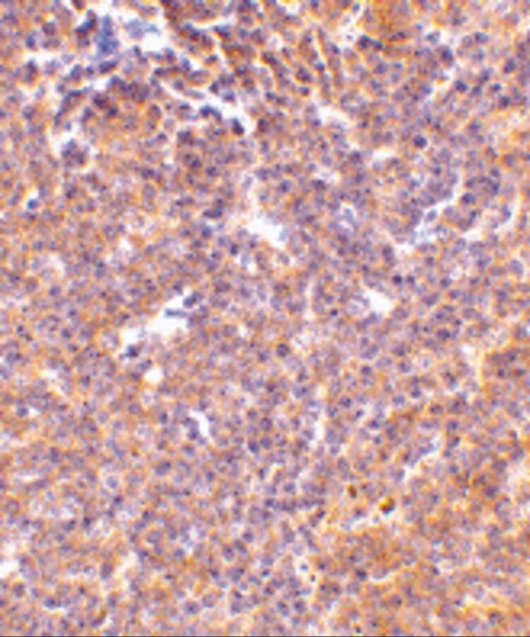 PAK2 Antibody - BSA Free