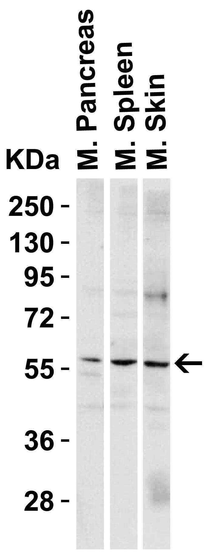 PAK2 Antibody - BSA Free