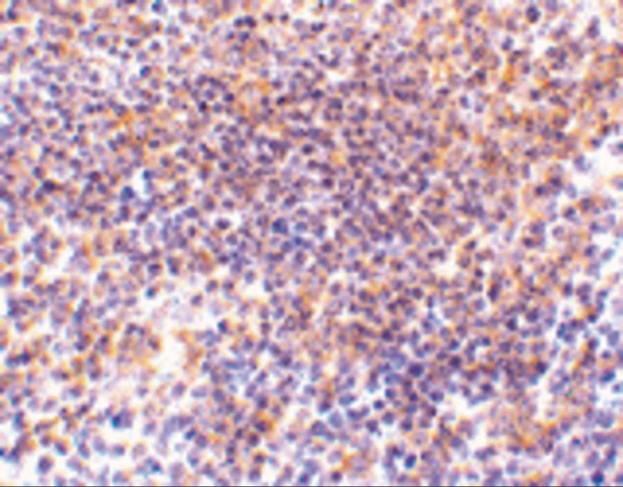 PAK2 Antibody - BSA Free