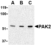 PAK2 Antibody - BSA Free