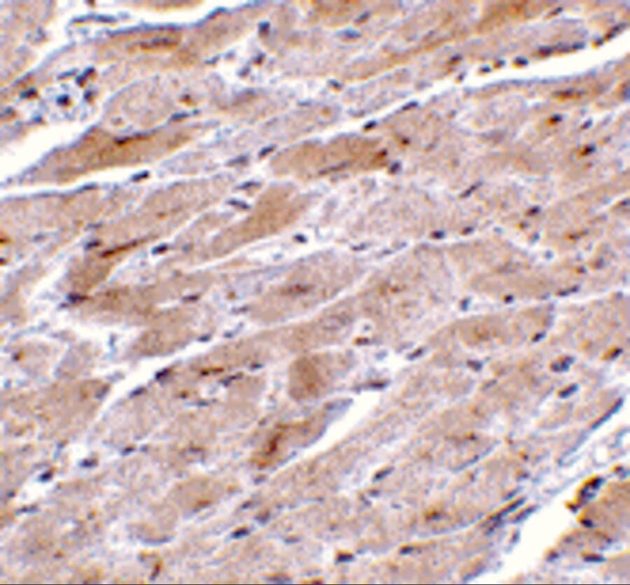 TRPC3 Antibody - BSA Free